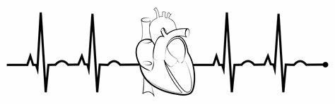 Basic ECG Rhythm Interpretation